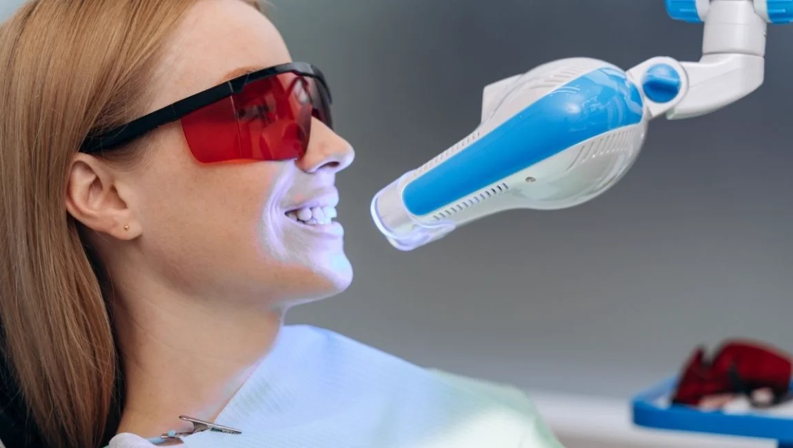 Combien de temps dure un blanchiment dentaire ? Guide complet du bleaching