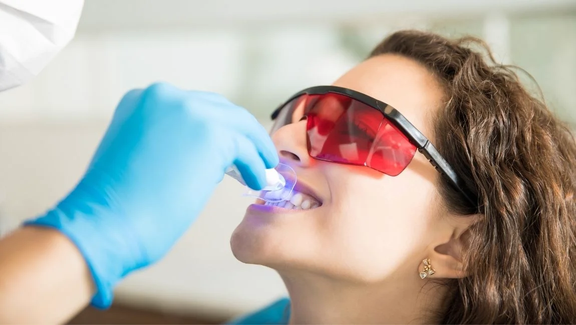 Pourquoi les dents jaunissent elles ? Que faut il savoir sur le blanchiment dentaire ?