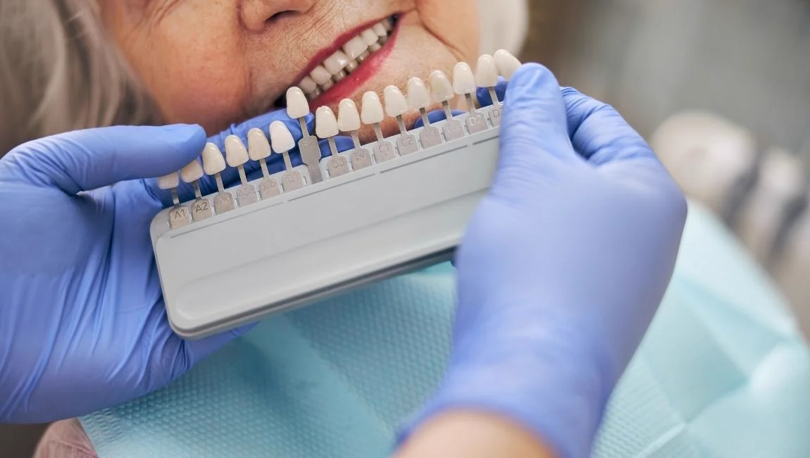 Composite, facette en céramique et couronne en zircone: quand choisir chaque traitement?