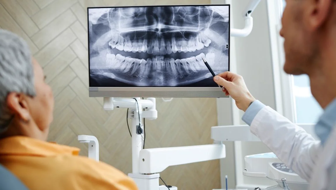 Solution zygomatique en cas de perte osseuse: comment se déroule la pose et à qui convient elle ?